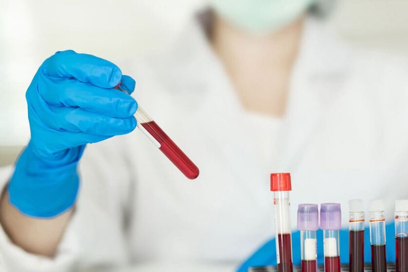 Si può bere alcolici prima di donare il sangue